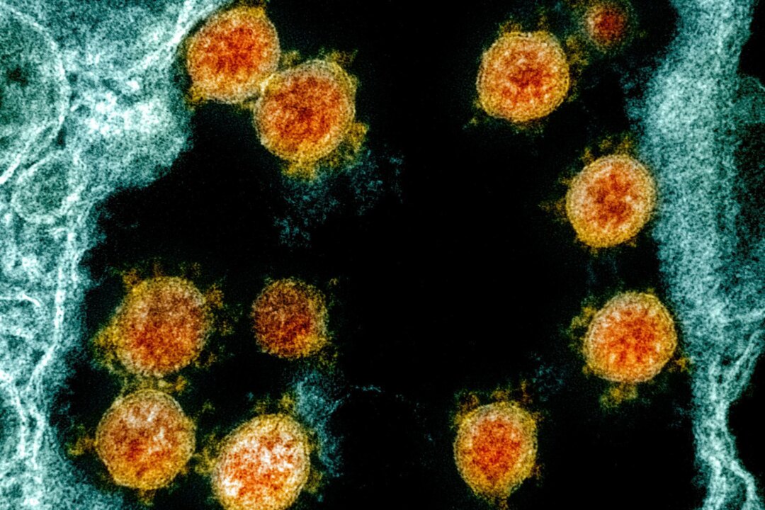 613 Tage lang Corona: Seltener Infektionsfall vorgestellt - Elektronenmikroskopische Aufnahme des Coronavirus SARS-CoV-2.
