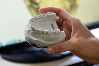 Aligner: Mit Schienen aus dem Internet zu geraden Zähnen? - Bei einigen Aligner-Anbietern startet die Behandlung mit einem Zahnarzt-Besuch, bei dem ein Abdruck des Kiefers genommen wird.