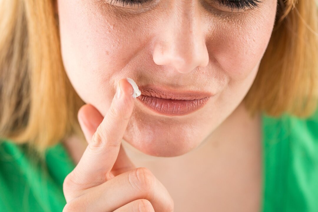 Autsch! Was hilft bei eingerissenen Mundwinkeln? - Gegen die trockene Haut und damit gegen Rhagaden: Gerade im Winter ist eine gute Haut- und Lippenpflege wichtig. (zu dpa: "Autsch! Was hilft bei eingerissenen Mundwinkeln?")
