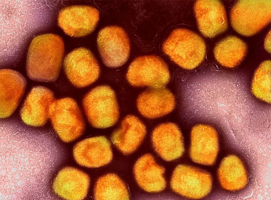 WHO sieht Gefahrenpotenzial bei Mpox - Eine kolorierte transmissionselektronenmikroskopische Aufnahme von Partikeln des Affenpockenvirus. Die WHO hat wegen Mpox-Ausbrüchen in zahlreichen Ländern 2022 eine internationale Notlage ausgerufen.